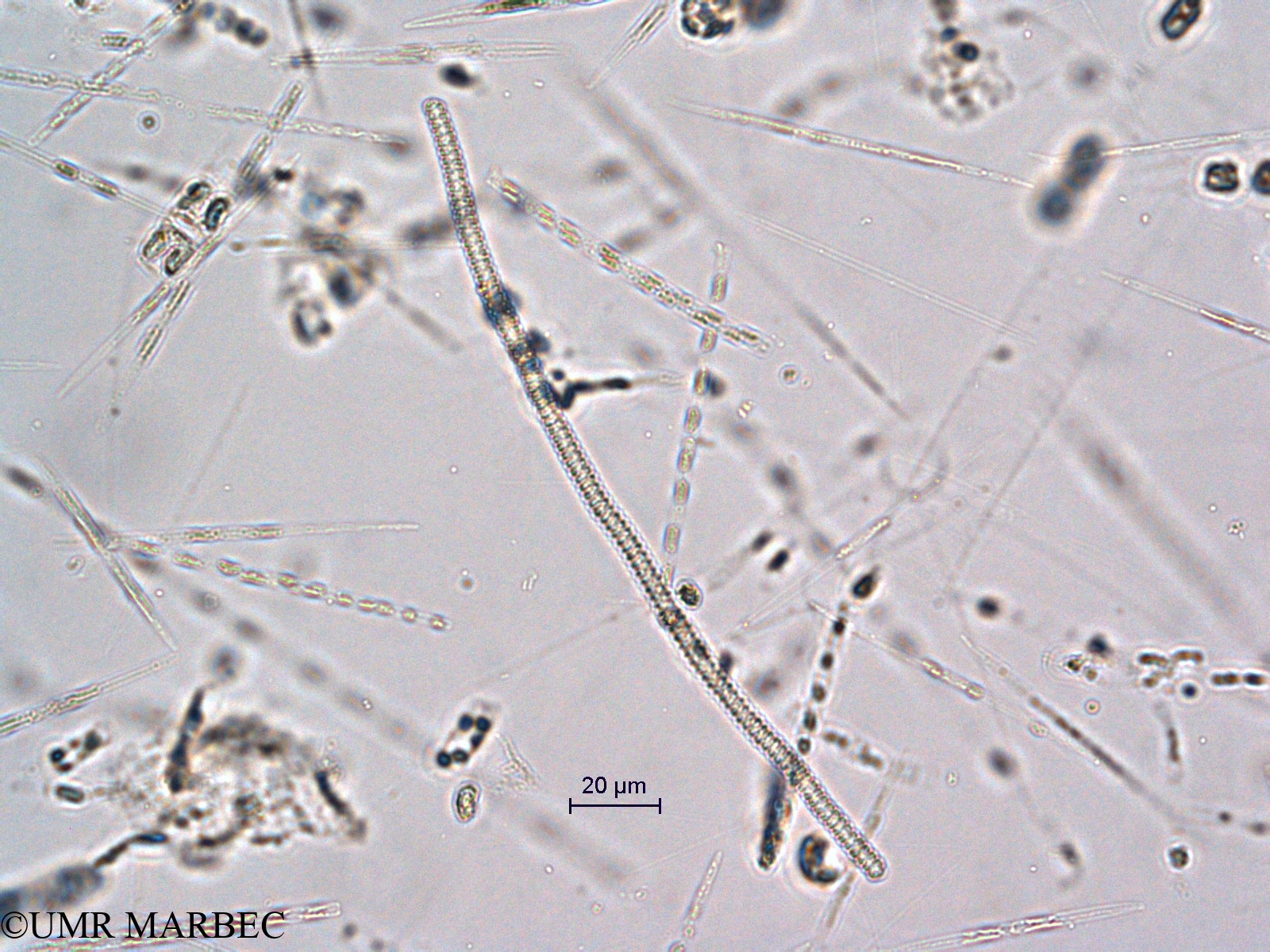 phyto/Scattered_Islands/all/COMMA April 2011/Spirulina spp (ancien S. sp2 -1)(copy).jpg